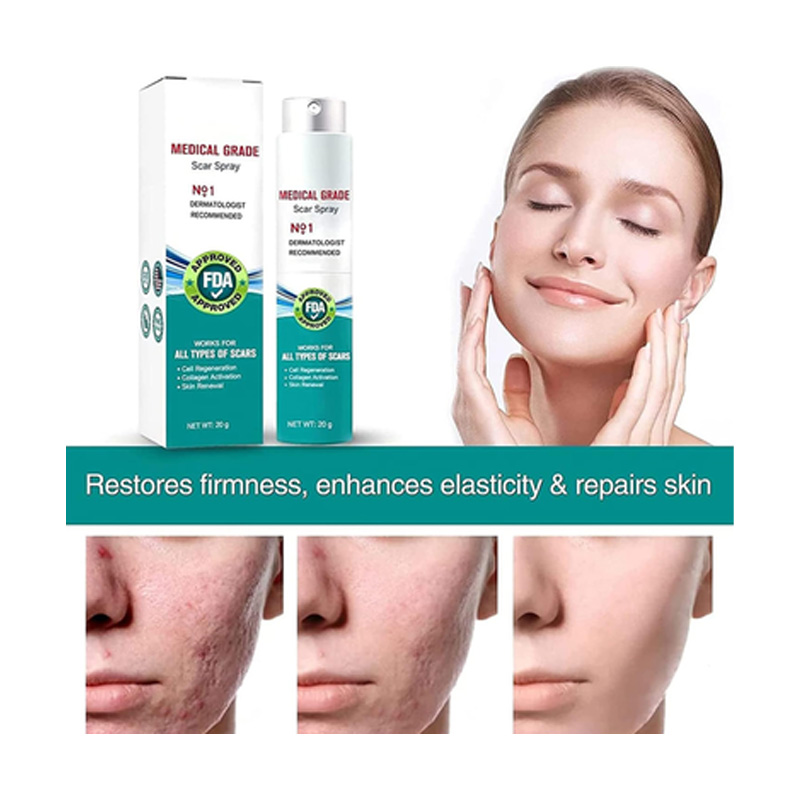 Picture of SOUTH MOON Medical Grade Scar Spray for Reduce Scars and Smooth Skin -20gm