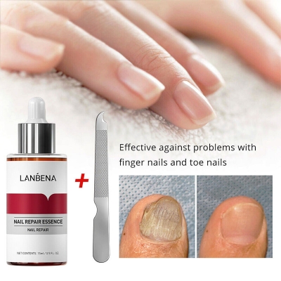 Picture of Lanbena Nail Fungal Treatment Remove Paronychia Onychomycosis Toe Nail Repairing,Treatment Toe Nail Repair Essence Nail Solution-15Ml