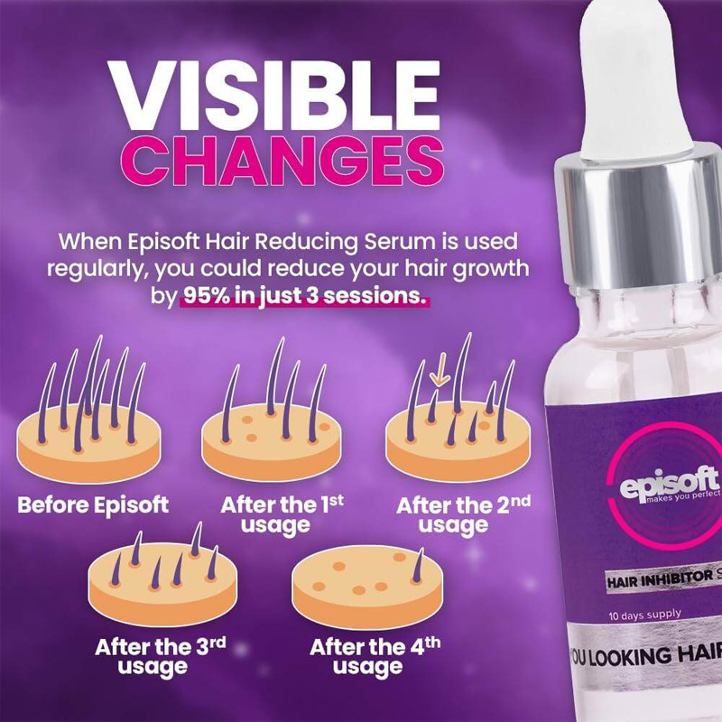Picture of Inova Episoft Hair Removal Inhibitor Serum -30ml - White