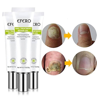 Picture of Efero Nail Cream Treatment Repair Gel and Luster -20gm
