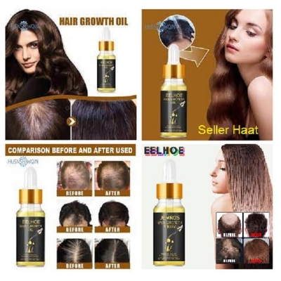 Picture of EELHOE HAIR GROWTH OIL.