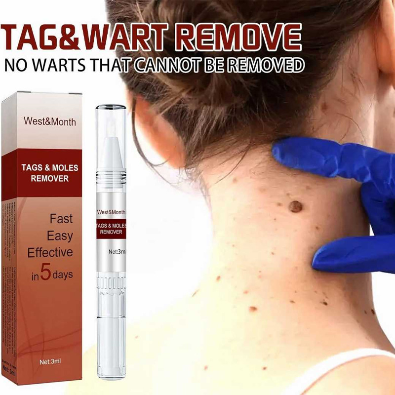 Picture of WEST MONTH TAGS MOLES REMOVER PEN 3ML - White