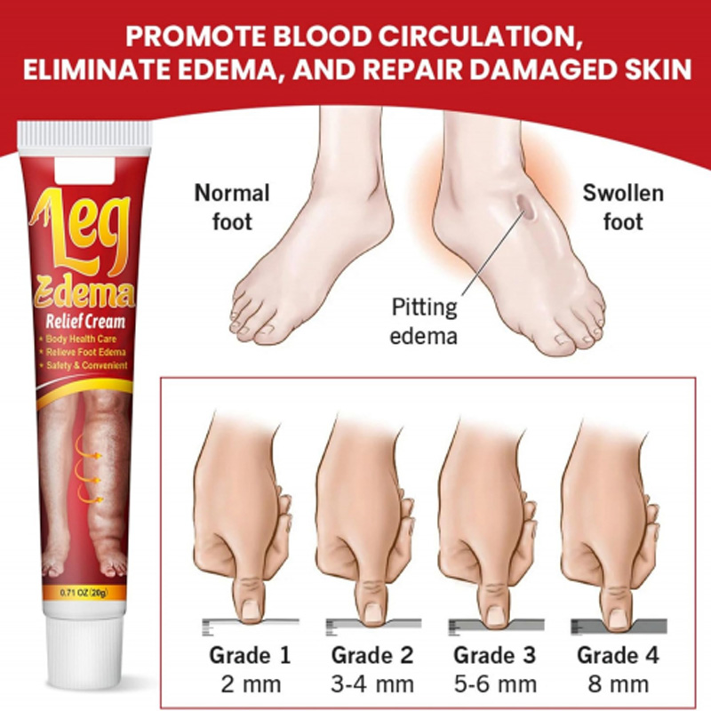 Picture of Sumifun Leg Edema Relief Cream - Red