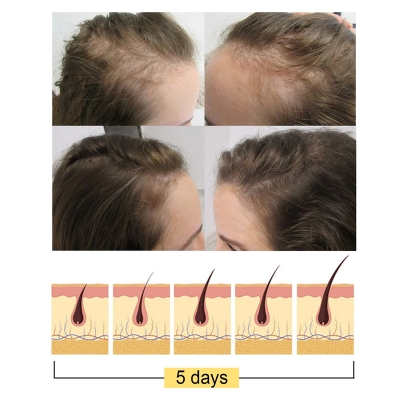Picture of Jaysuing Anti Falling Hair Shampoo Longsheng Rice. - Black