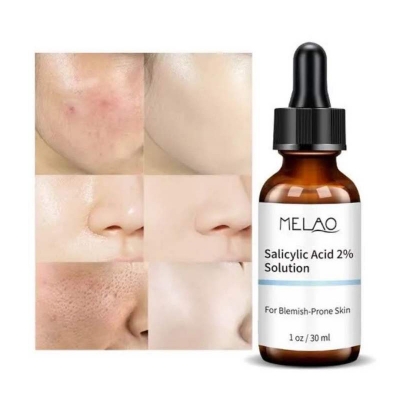 Picture of Malao 2% Salicylic Acid Serum - White