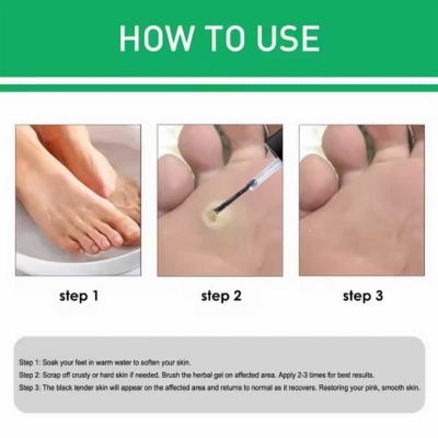 Picture of Jaysuing Active Corn Remover Strengthen Gel