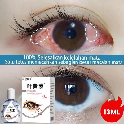 Picture of Lutein Eye Drops Relieve Fatigue Presbyopia Improve Vision Eye 13ml - White