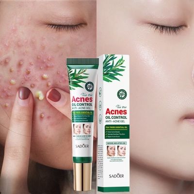 Picture of Sadore tea tree acnes oil control anti acne gel - White