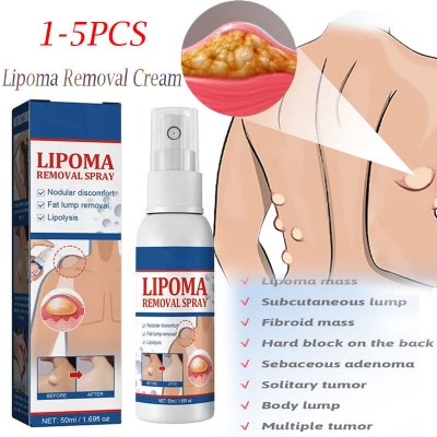 Picture of South moon Lipoma Removal Spray. it is a topical spray designed to help with the removal of benign lipomas which are soft,fatty, lumps that grow under the skin 50ml