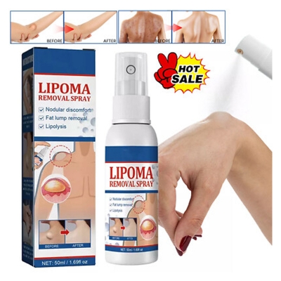 Picture of South moon Lipoma Removal Spray. it is a topical spray designed to help with the removal of benign lipomas which are soft,fatty, lumps that grow under the skin 50ml
