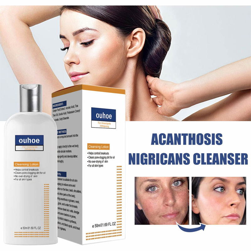 Picture of Ouhoe Blemish Skin Clarifying Cleansing Lotion 50ml