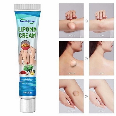 Picture of South moon Lipoma Cream 20ml