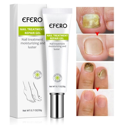 Picture of Efero Nail Treatment Repair Gel 20gm