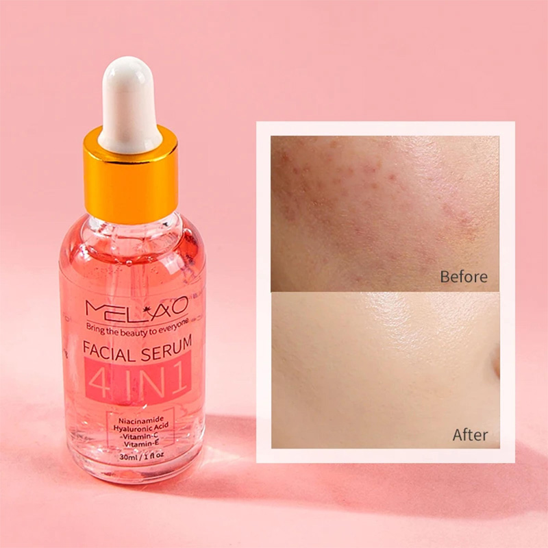 Picture of MELAO Brightening Vitamin C 4 In 1 skin Facial Serum 30ml
