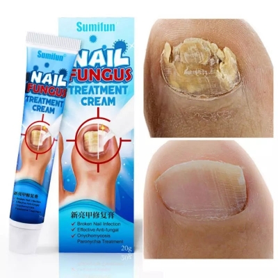 Picture of South moon condisolve Nail care soothing cream