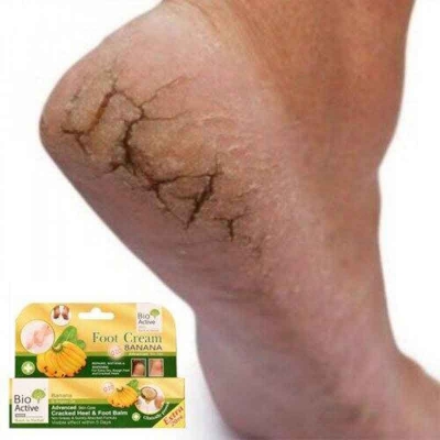 Picture of Bio Active Banana & Argan oil cracked Heel & Foot Balm -30ml