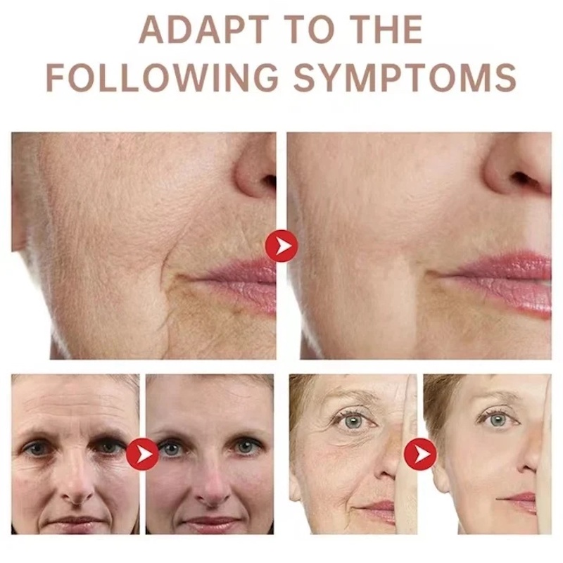 Picture of Collagen Neck Cream Eliminate Neck Wrinkle Lines Lifting Whitening Tighten Double Chin Anti-age Rejuvenation Skin Care Cream