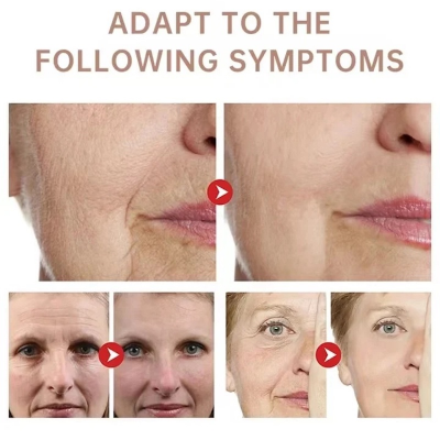 Picture of Collagen Neck Cream Eliminate Neck Wrinkle Lines Lifting Whitening Tighten Double Chin Anti-age Rejuvenation Skin Care Cream