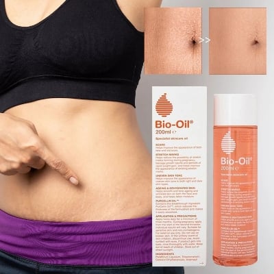 Picture of Bio-Oil Skincare Body Oil 200 ml – Scar & Stretchmark Serum, Moisturizer for Dry Skin, Non-Greasy & Non-Comedogenic