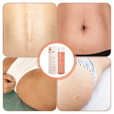 Picture of Bio-Oil Skincare Body Oil 200 ml – Scar & Stretchmark Serum, Moisturizer for Dry Skin, Non-Greasy & Non-Comedogenic