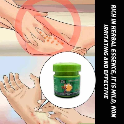 Picture of Fezema Graffi Eczema Cream – 20g Psoriasis & Dermatitis Treatment – Chinese Herbal Anti-Itch Ointment for Cracked, Scaly Skin Repair