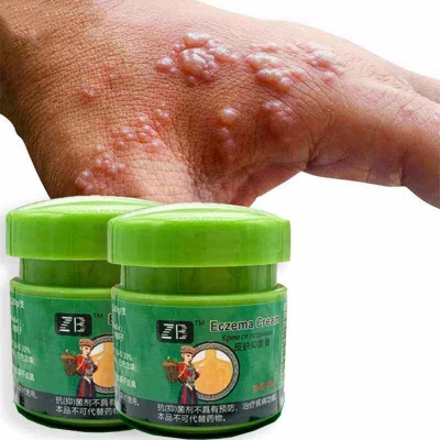 Picture of Fezema Graffi Eczema Cream – 20g Psoriasis & Dermatitis Treatment – Chinese Herbal Anti-Itch Ointment for Cracked, Scaly Skin Repair