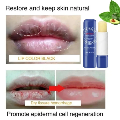 Picture of Voliko Lip Repair & Moisturizing Balm | Nourishing Care for Dry Lips | Softening & Smoothing Lip Treatment | Helps Improve Lip Tone & Reduce Lip Dryness | 3.2g