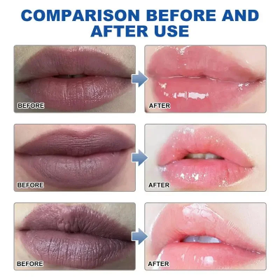 Picture of Voliko Lip Repair & Moisturizing Balm | Nourishing Care for Dry Lips | Softening & Smoothing Lip Treatment | Helps Improve Lip Tone & Reduce Lip Dryness | 3.2g