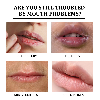 Picture of Voliko Lip Repair & Moisturizing Balm | Nourishing Care for Dry Lips | Softening & Smoothing Lip Treatment | Helps Improve Lip Tone & Reduce Lip Dryness | 3.2g