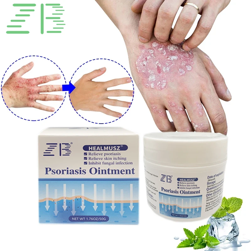 Picture of HEALMUSZ Skin Soothing Cream 50g | Herbal Anti-Itch & Moisturizing Ointment | Cooling Menthol & Camphor Formula for Dry, Rough & Irritated Skin