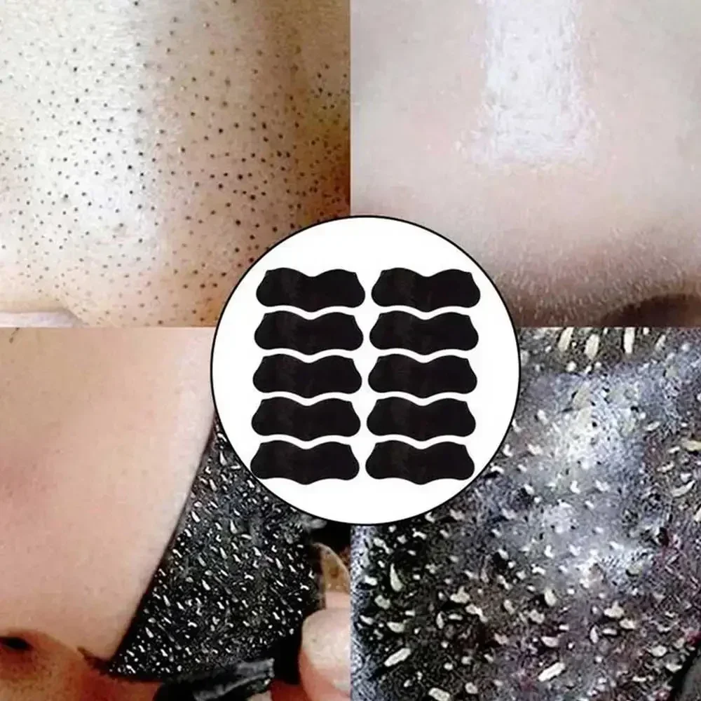Picture of 10/20pcs Blackhead Removal Nose Strips | Bamboo Charcoal Deep Cleansing Pore Strips | Instant Acne & Oil Control Nose Patch