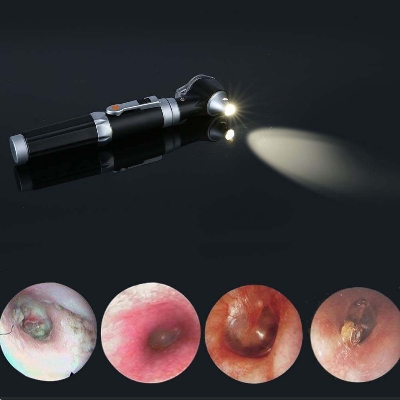 Picture of Mini Otoscope - Magnification Diagnostic Ear Scope With LED Direct Illumination Light, Health Tool for Doctors, Nurses, Adults, Kids, Baby, Elder, Pets, Animals - Int: One size