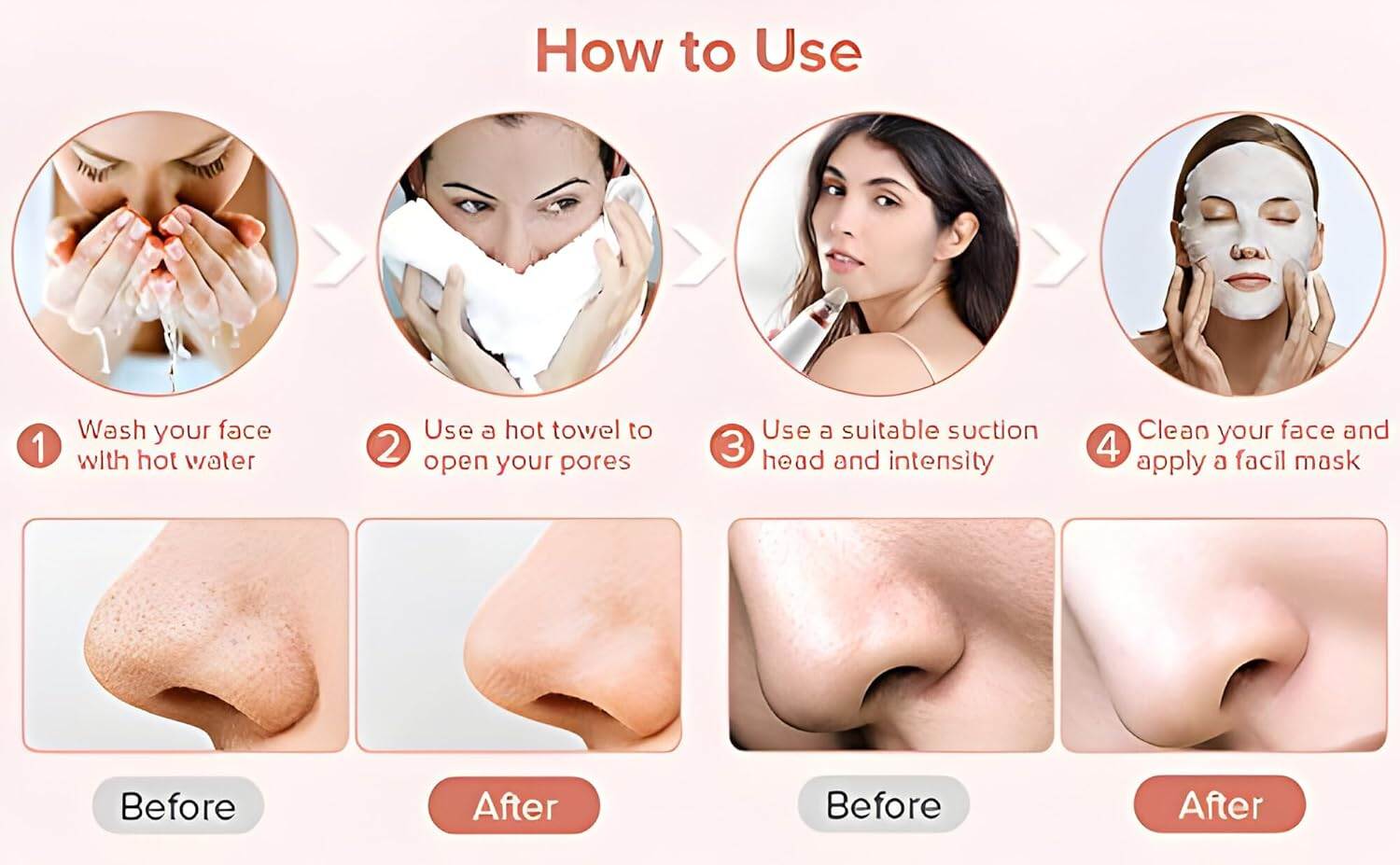 Picture of 6 In 1 Multi-Function Blackhead Remover Tool, USB Rechargeable Derma suction Machine, Pimple Removal Tool for Men and Women - Int: One size