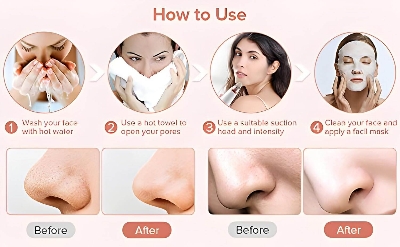 Picture of 6 In 1 Multi-Function Blackhead Remover Tool, USB Rechargeable Derma suction Machine, Pimple Removal Tool for Men and Women - Int: One size