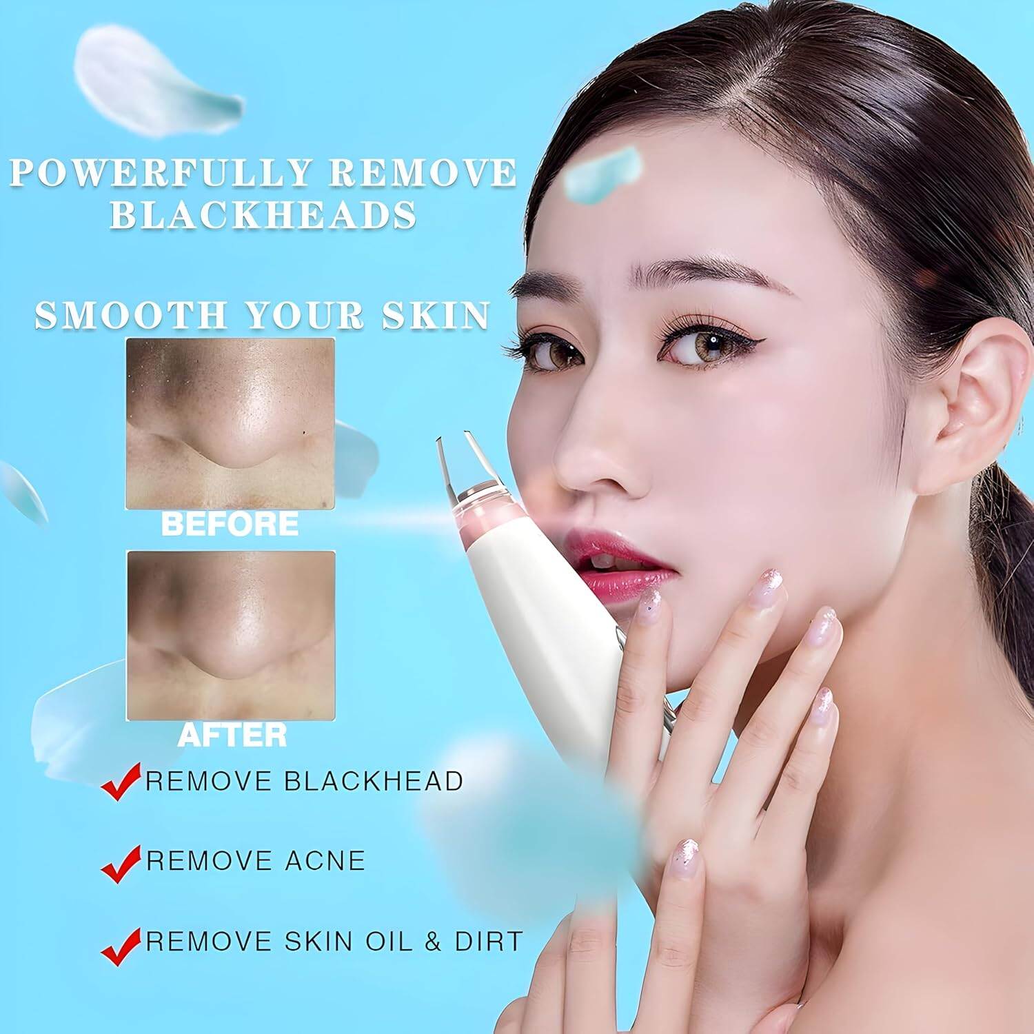 Picture of 6 In 1 Multi-Function Blackhead Remover Tool, USB Rechargeable Derma suction Machine, Pimple Removal Tool for Men and Women - Int: One size