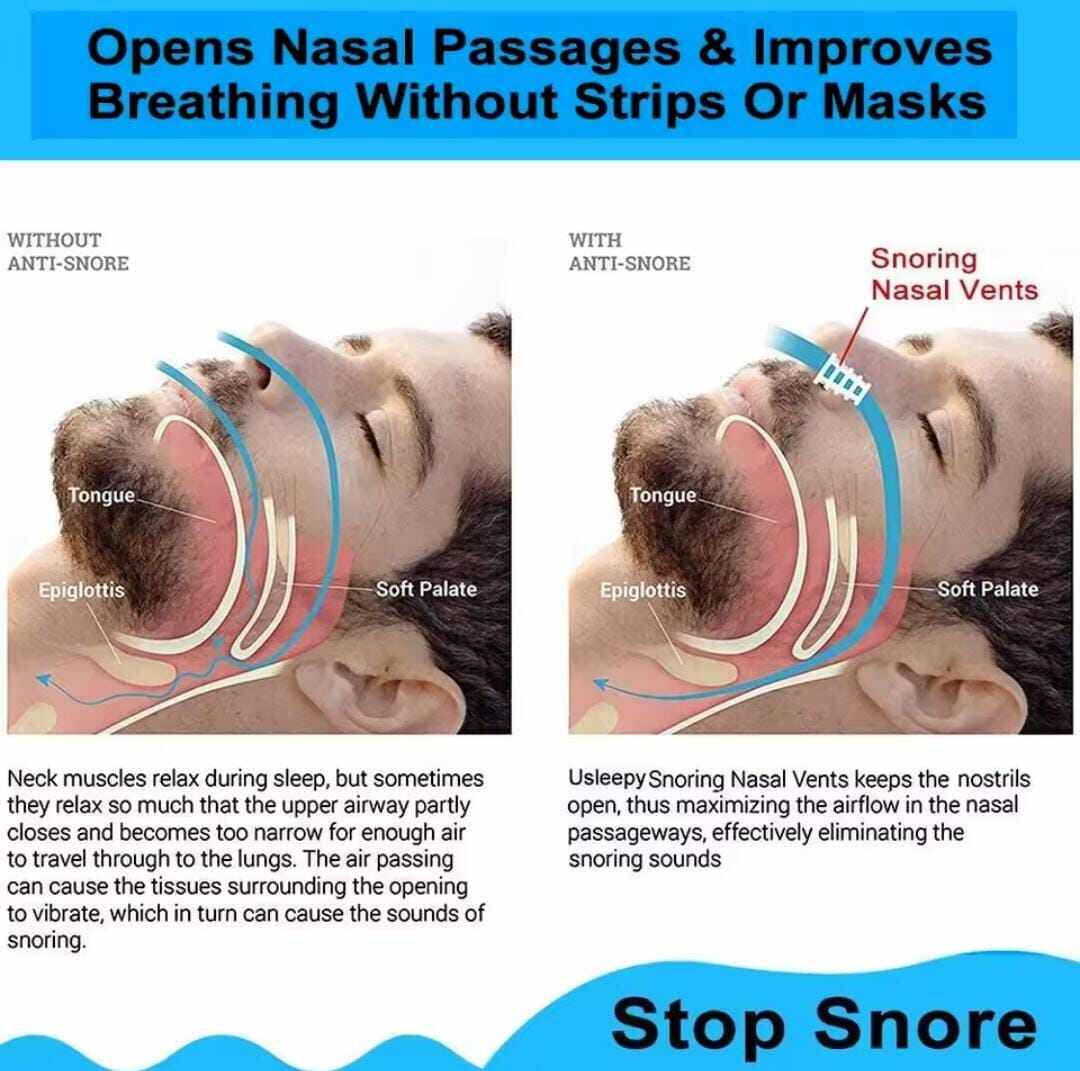 Picture of 8pc Anti-Snoring Device Prevent Snoring Sleeping Prevent Nasal Congestion Snoring Nose Clip Easy Breathe Improve Sleeping - Multicolor - Int: One size