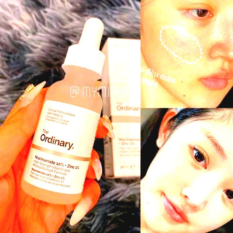 Picture of niyacinamind 30ml - Mint