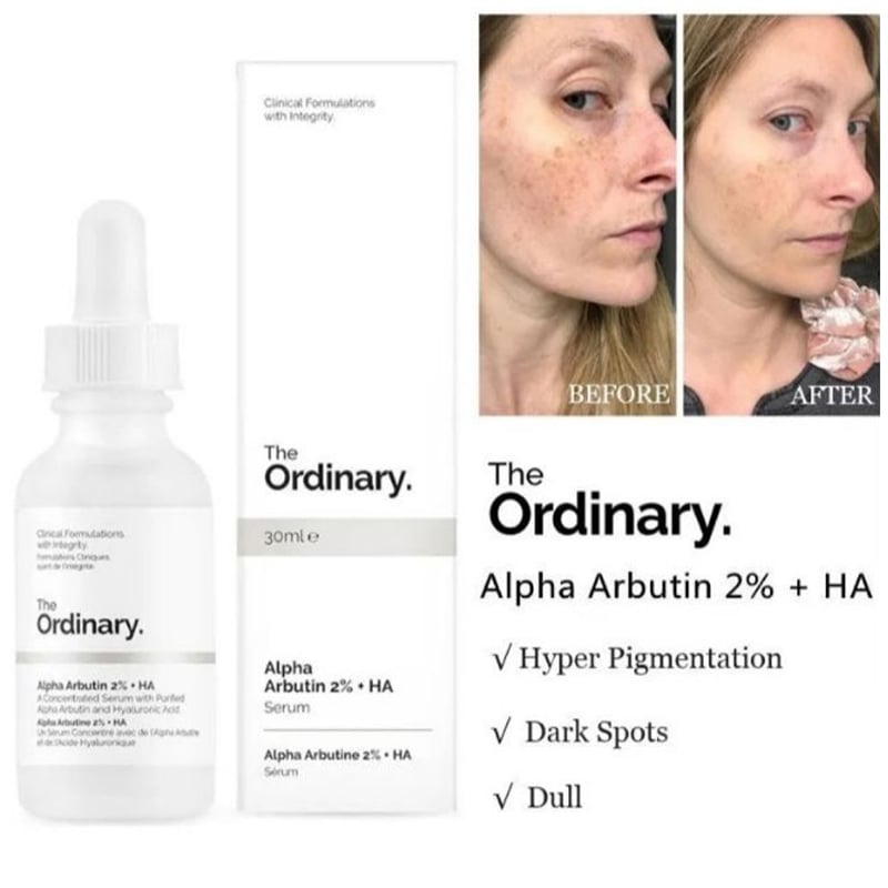 Picture of Alpha Arbutin 2 Percent HA Serum Skin Brightening Dark Spot Corrector Hyaluronic Acid Facial Care