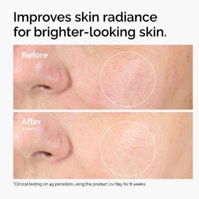 Picture of Alpha Arbutin 2% with HA Skin Brightening And Age Defying Serum for Even Skin Tone And Wrinkle Reduction