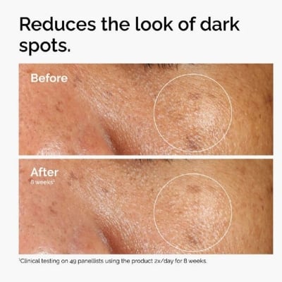 Picture of Alpha Arbutin 2% with HA Skin Brightening And Age Defying Serum for Even Skin Tone And Wrinkle Reduction