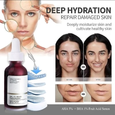 Picture of AHA 30% BHA 2% Peeling Solution Exfoliating Skin Care for Face And Body