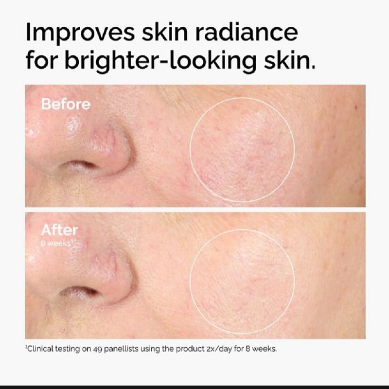 Picture of Alpha Arbutin 2% + HA Skin Lightening And Brightening Serum for Dark Spots And Age Spots 30ml