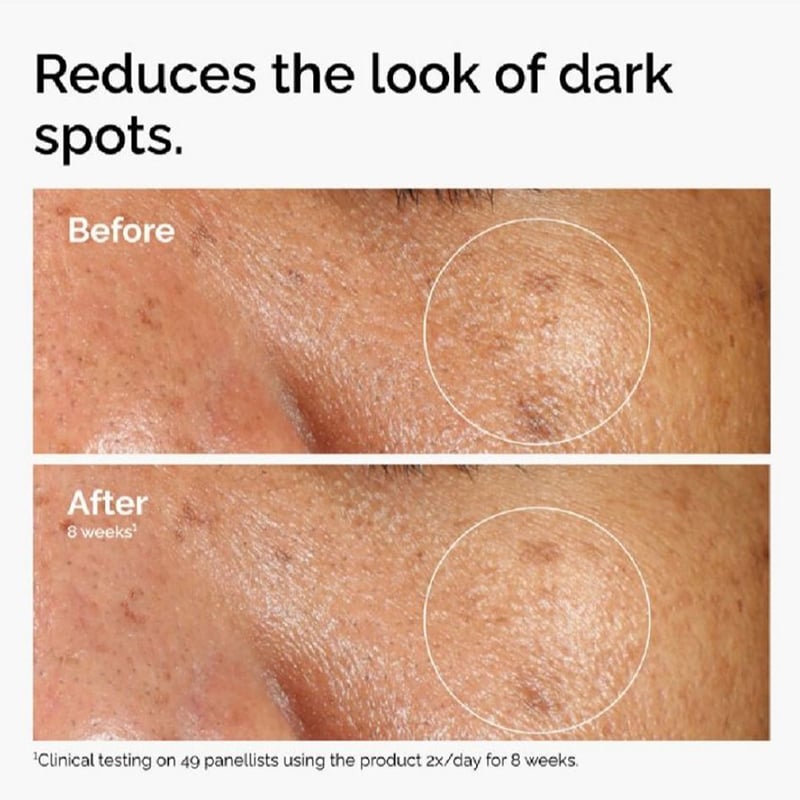 Picture of Alpha Arbutin 2% + HA Skin Lightening And Brightening Serum for Dark Spots And Age Spots 30ml