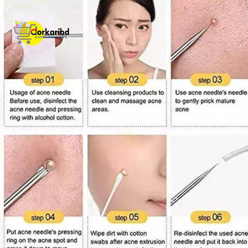 Picture of 4Pc/Set Stainless Steel Blackhead Removal Kit Acne Blemish Pimple Extractor Remover Needles Tweezers Face Skin Care Tool