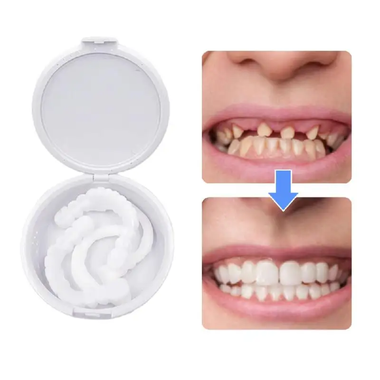 Picture of Silicone Denture Reline Kit Soft Comfortable And Firm Denture Silicone Reline Kit Instant Safe And Durable Instant Teeth - White