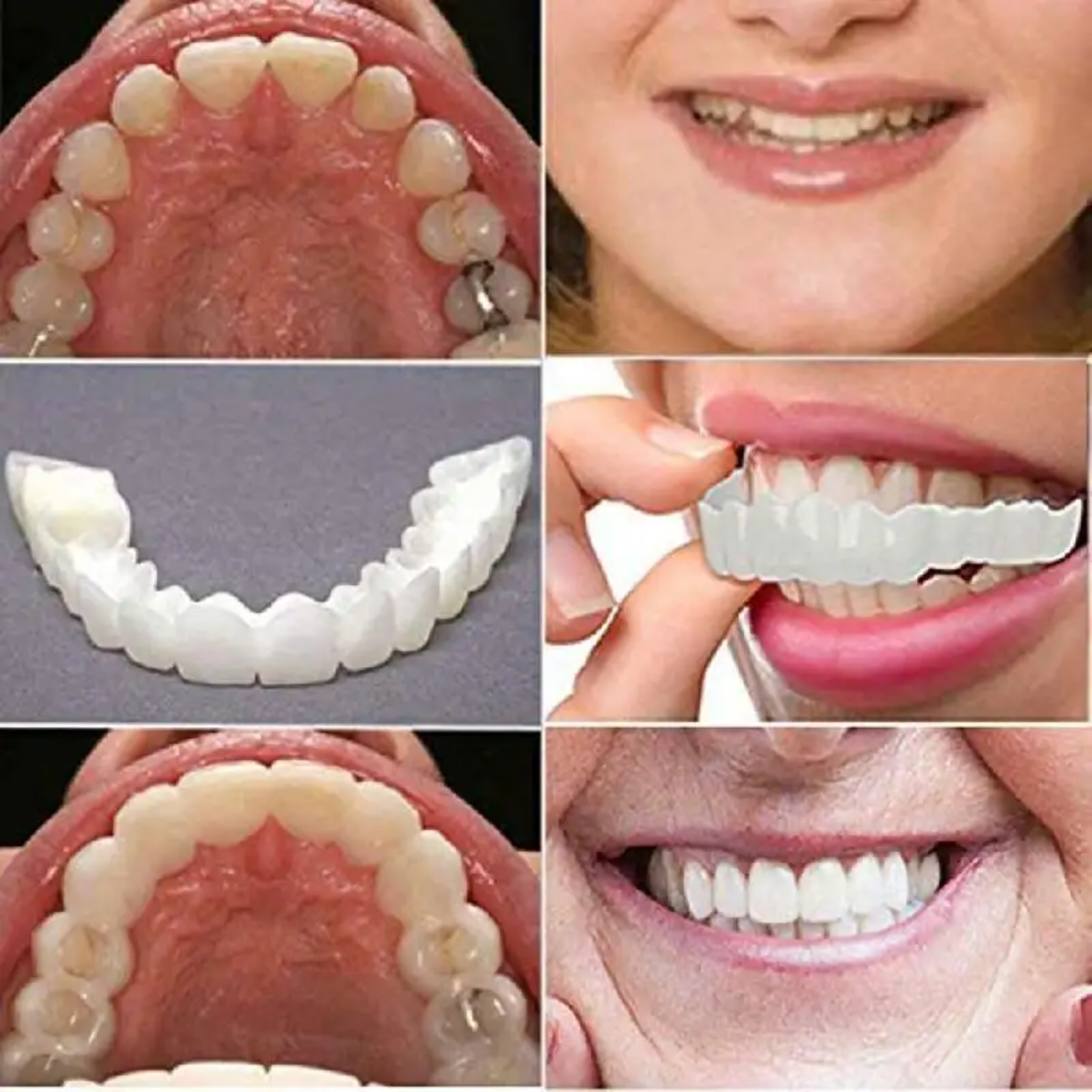 Picture of Silicone Denture Reline Kit Soft Comfortable And Firm Denture Silicone Reline Kit Instant Safe And Durable Instant Teeth - White