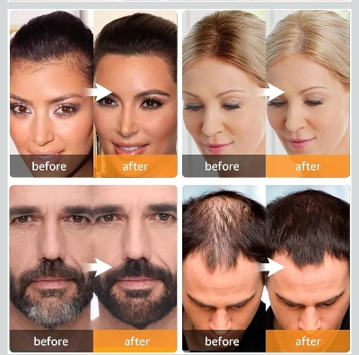 Picture of Hair Line Powder Black Root Cover Up Natural Instant Waterproof Hairline Shadow Powder Hair Concealer Coverage