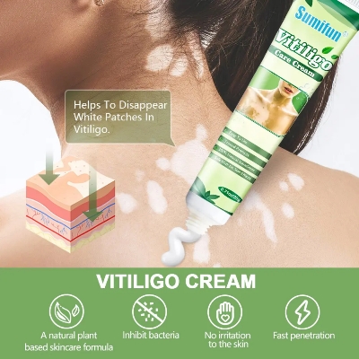 Picture of 20g Herbal Vitiligo Treatment Cream – Natural Spot Removal Ointment for vitiligo Spots Pigmentation & Brown Spots –Face & Body, Adults & Children