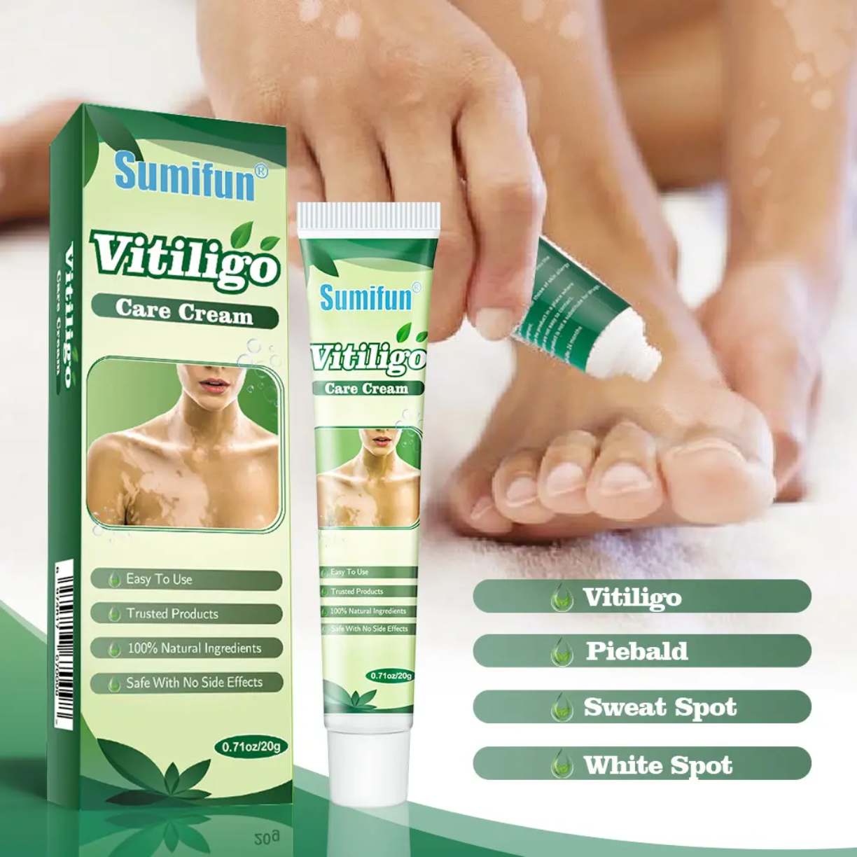 Picture of 20g Herbal Vitiligo Treatment Cream – Natural Spot Removal Ointment for vitiligo Spots Pigmentation & Brown Spots –Face & Body, Adults & Children