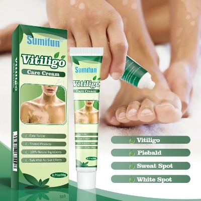 Picture of 20g Herbal Vitiligo Treatment Cream – Natural Spot Removal Ointment for vitiligo Spots Pigmentation & Brown Spots –Face & Body, Adults & Children